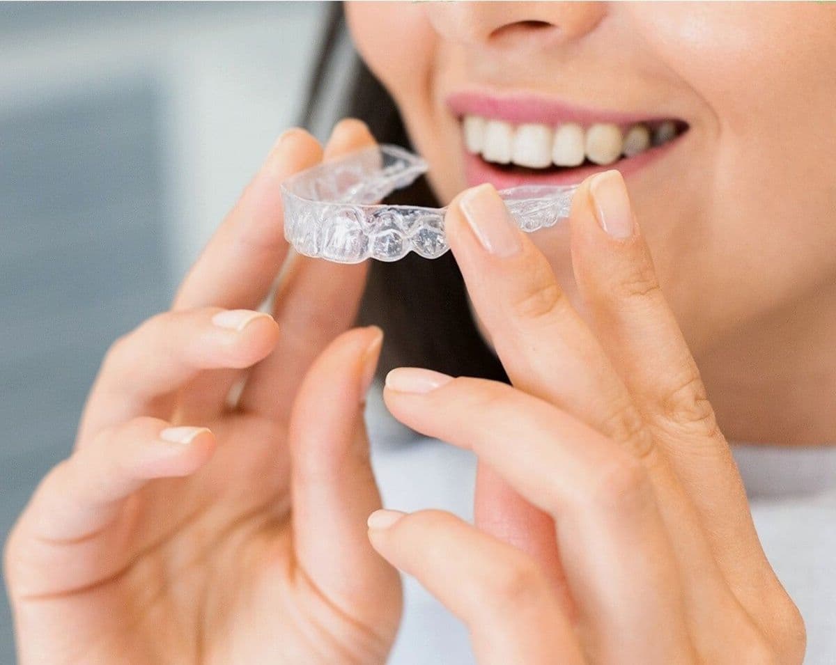 Transparente Aligner-Schiene vor einem Lächeln (Symbolbild)