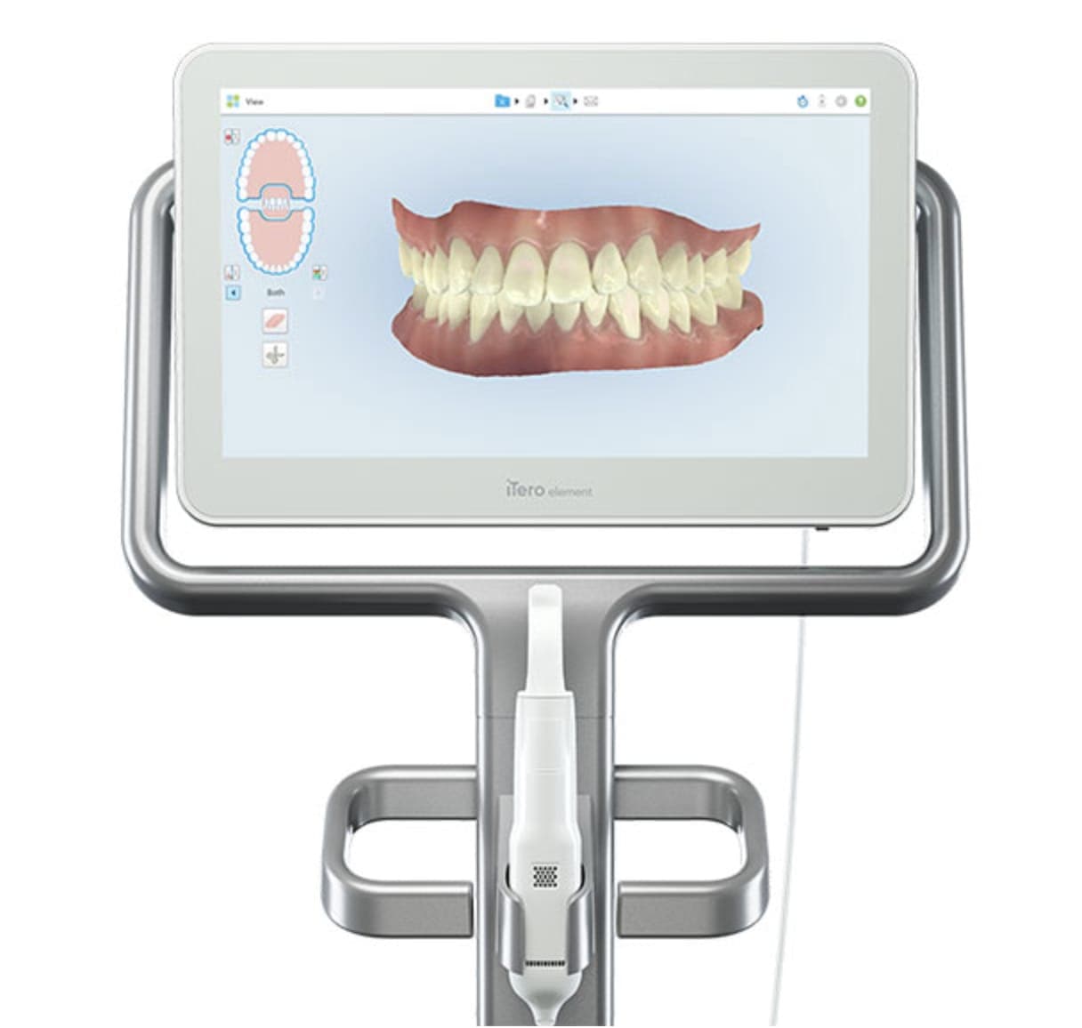 Digitale Abdrücke und Fotos mit dem Intraoralscanner (Beispielbild)